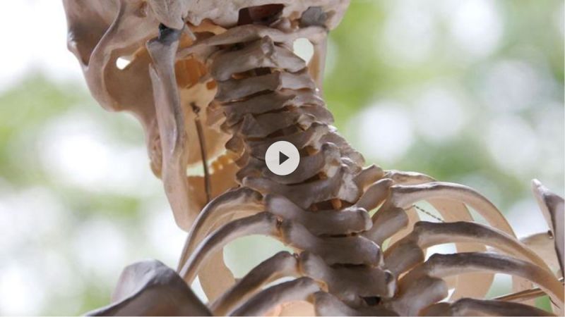 Leben mit Morbus Bechterew